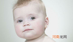 小儿营养性缺铁性贫血 主要表现为肤色苍白