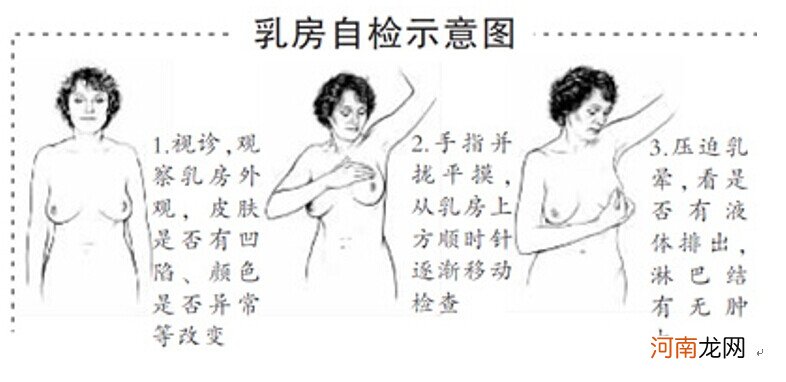 乳房自检手册