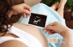 产检运动和睡眠、胎教