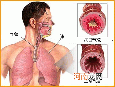 诊断支气管哮喘应做哪些检查