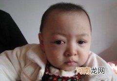 宝宝眼癌的早期症状 眼睛发红、肿胀对眼或斜视