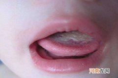 孩子舌苔发白是什么原因？别担心，无外乎这几种情况