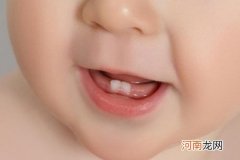 聪明早说话、富贵晚长牙 长牙长得早的宝宝聪明吗？