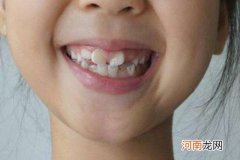 孩子换牙长歪了的图片 恒牙长歪会自动调整吗？