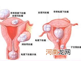 宫颈性不孕的七大原因