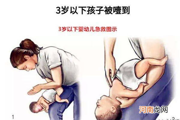 婴幼儿异物卡喉的急救方法 小儿海姆立克急救法过程
