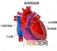 引起先天性心脏病的原因有哪些