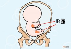 新生儿脸上胎记怎么形成的 婴儿胎记是怎么形成的原因