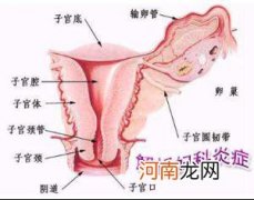 备孕女性有阴道炎的用药法
