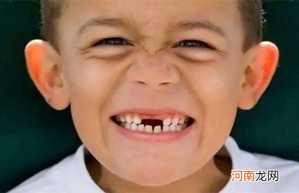 儿童换牙顺序图20颗 第一个换的竟是中切牙