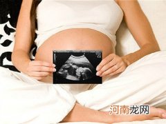 母乳性黄疸的处理办法