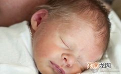 新生儿护理 婴儿的乳痂可以用手抠吗