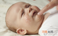 婴儿湿疹反复发作时 如何正确用药