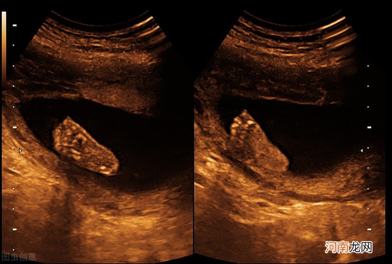 胎宝宝的生长发育 胎儿发育标准对照图