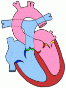 心血管疾病为什么要作动态心电图检查