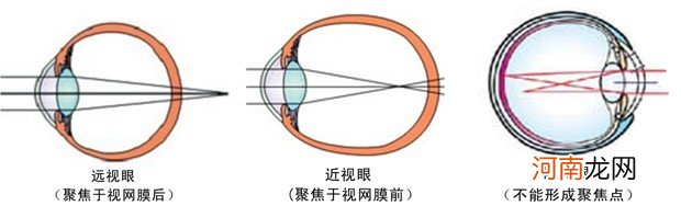 保护眼睛，从吃做起