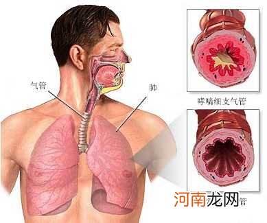 支气管哮喘多在夜间发作的原因是什么