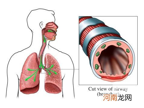 哪些疾病怀孕前必须治愈