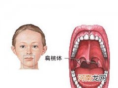 小儿支气管炎的特点及家庭护理