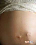 胎动和妊娠期腹痛怎么区分