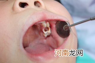 13个坏习惯危害孩子健康