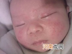 夏季宝宝长痱子怎么办 两款痱子食疗方