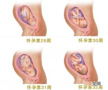 哺乳妈妈如何预防和应对乳头皲裂