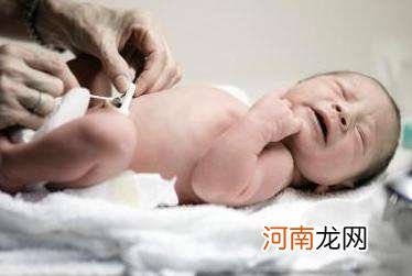 新生儿肚脐护理 如何保证宝宝肚脐卫生