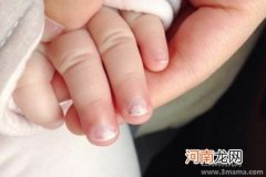 怎么从宝宝指甲辨别健康状况