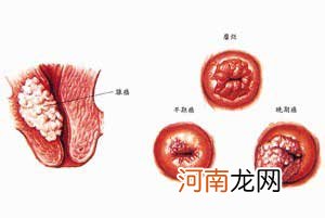 婴幼儿睡眠受挫 专家建议改造“微环境”