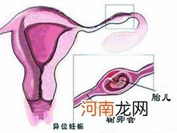 寒冷冬天如何护理好新生儿呢