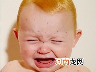 产妇三防冬燥：静电 唇干 鼻出血