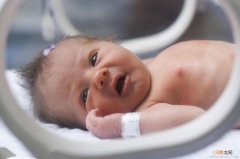 新生儿睡眠呼吸异常的常见症状