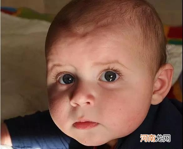 宝宝脸皴起皮学会这8招 宝宝脸皴了怎么办