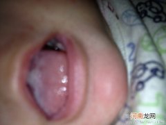 宝宝缺舌苔是什么原因呢？