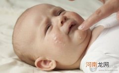 婴儿痤疮是什么 婴儿痤疮怎么治
