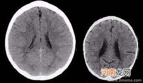 如何使孩子的大脑处于最佳状态呢？