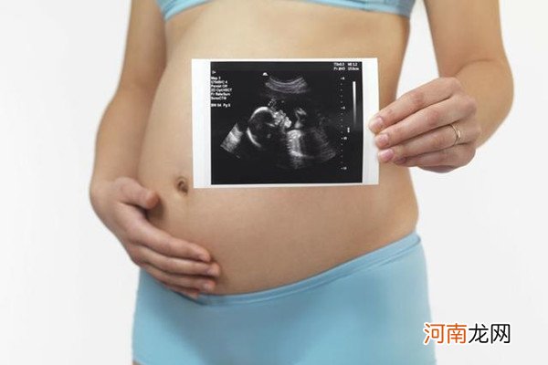 什么孕妇容易生畸形儿 4类孕妇几率大，望你不在其中！