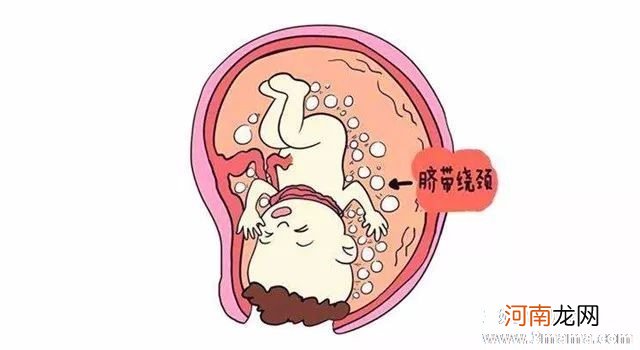 来不及去医院要生了怎么办？