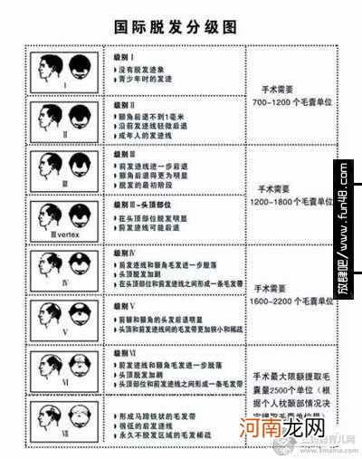 种植头发多少钱?均价在8-12元/单位