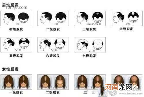 种植头发多少钱?均价在8-12元/单位