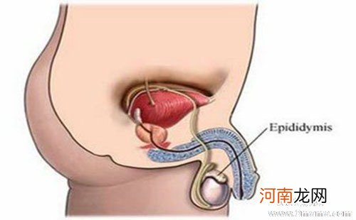 附睾炎的症状有哪些