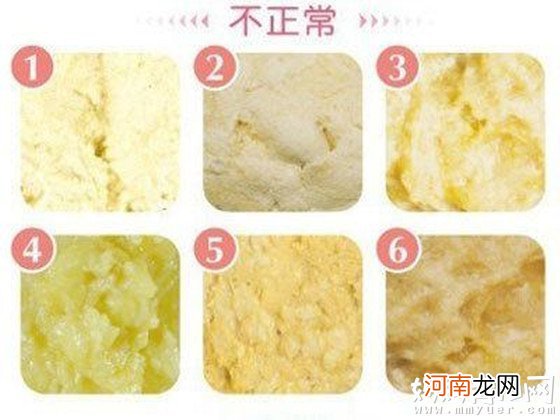 婴儿大便有泡沫的原因不止消化不良那么简单