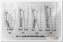 日常生活小tips：预防O型腿、X型腿
