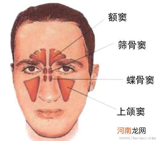 鼻炎的症状