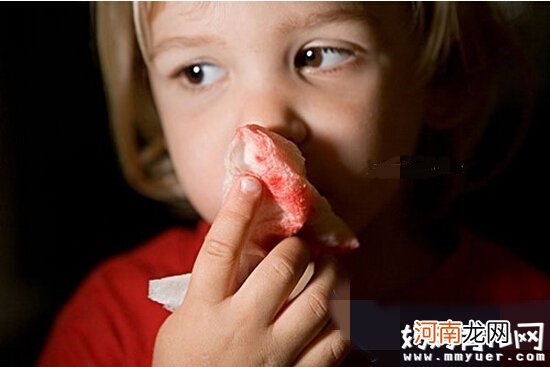 小孩总是流鼻血怎么办 推荐适合孩子流鼻血吃的食物