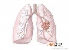 什么是肺结核