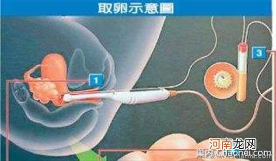 夫妻患有地中海贫血症，泰国第三代试管技术让我获得健康宝宝！ ...