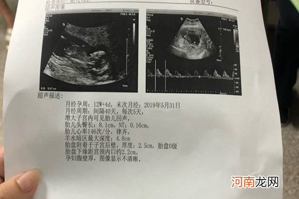 13周nt图弯着就是男孩 感觉讲得非常有道理