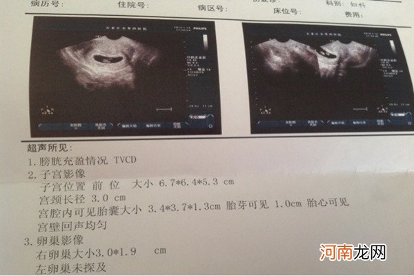 标准女孩孕囊 长是宽的二倍 想要女孩都来验证一下